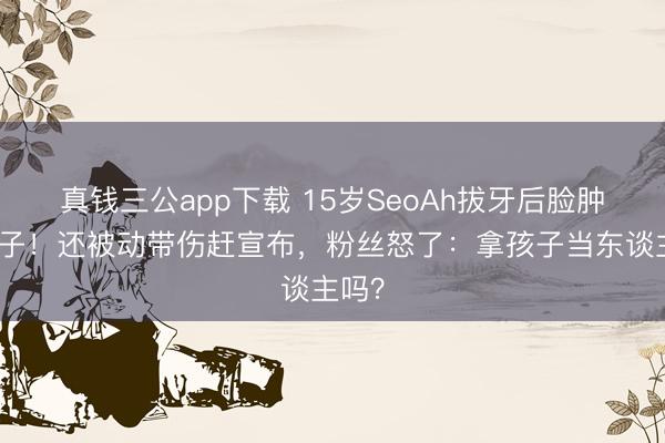 真钱三公app下载 15岁SeoAh拔牙后脸肿成包子！还被动带伤赶宣布，粉丝怒了：拿孩子当东谈主吗？